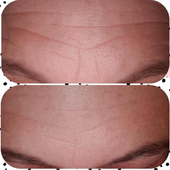 Nu Skin Tru Face Line Corrector Serum - Picture 5 of 6